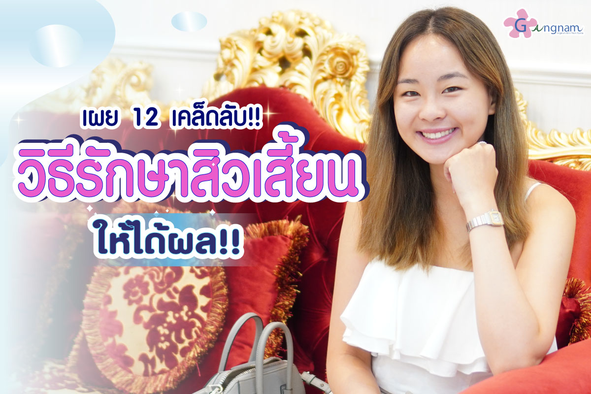 สิวเสี้ยน ป้องกันและรักษาอย่างไร