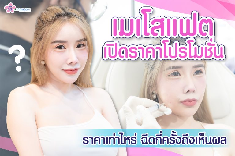 เมโสแฟต ราคาเท่าไหร่ ? แพง-ถูกต่างกันอย่างไร ควรฉีดกี่ครั้งถึงได้ผล