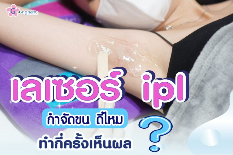 เลเซอร์ IPL กำจัดขน ยังดีไหม? ให้ผลลัพธ์ต่างจากเลเซอร์ตัวอื่นอย่างไร?