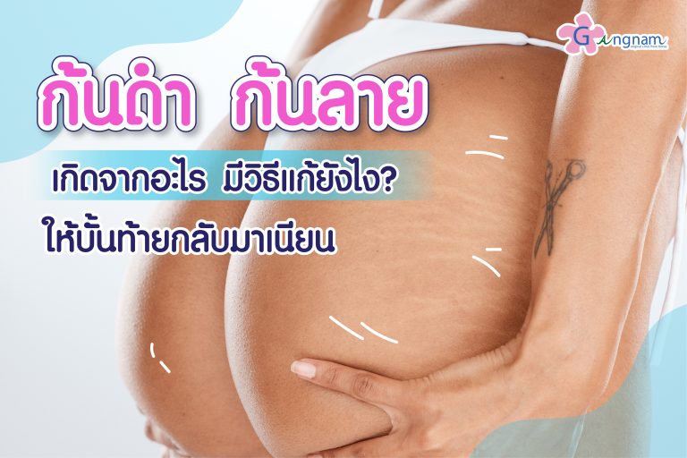 ก้นดำ ก้นลาย เกิดจากอะไร มีวิธีแก้ยังไง? ให้บั้นท้ายกลับมาเนียน