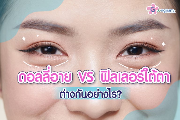ฉีดดอลลี่อาย VS ฟิลเลอร์ใต้ตา ข้อดี-ข้อเสีย ต่างกันอย่างไร เลือกทำด้วยวิธีไหนดี