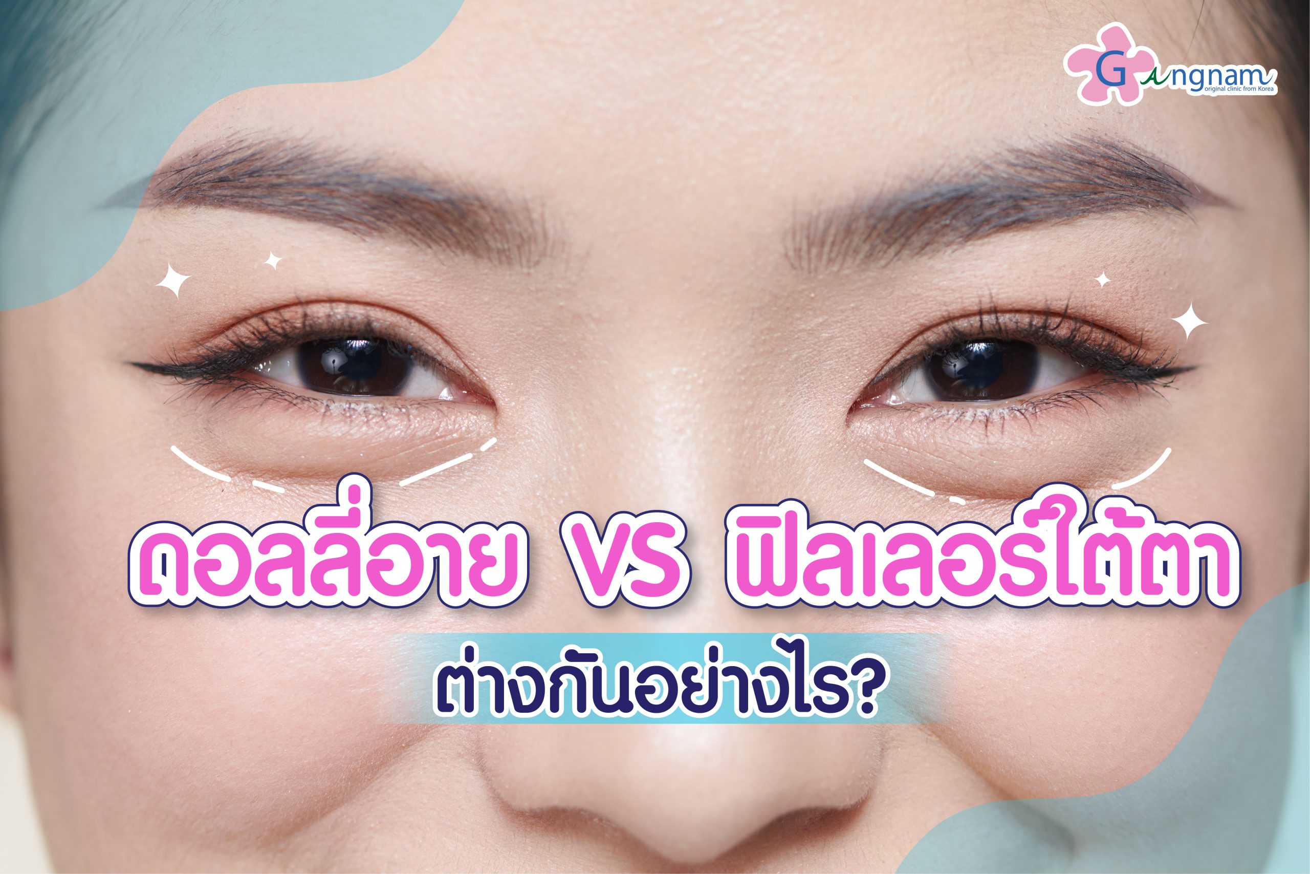 ฉีดดอลลี่อาย VS ฟิลเลอร์ใต้ตา ต่างกันอย่างไร