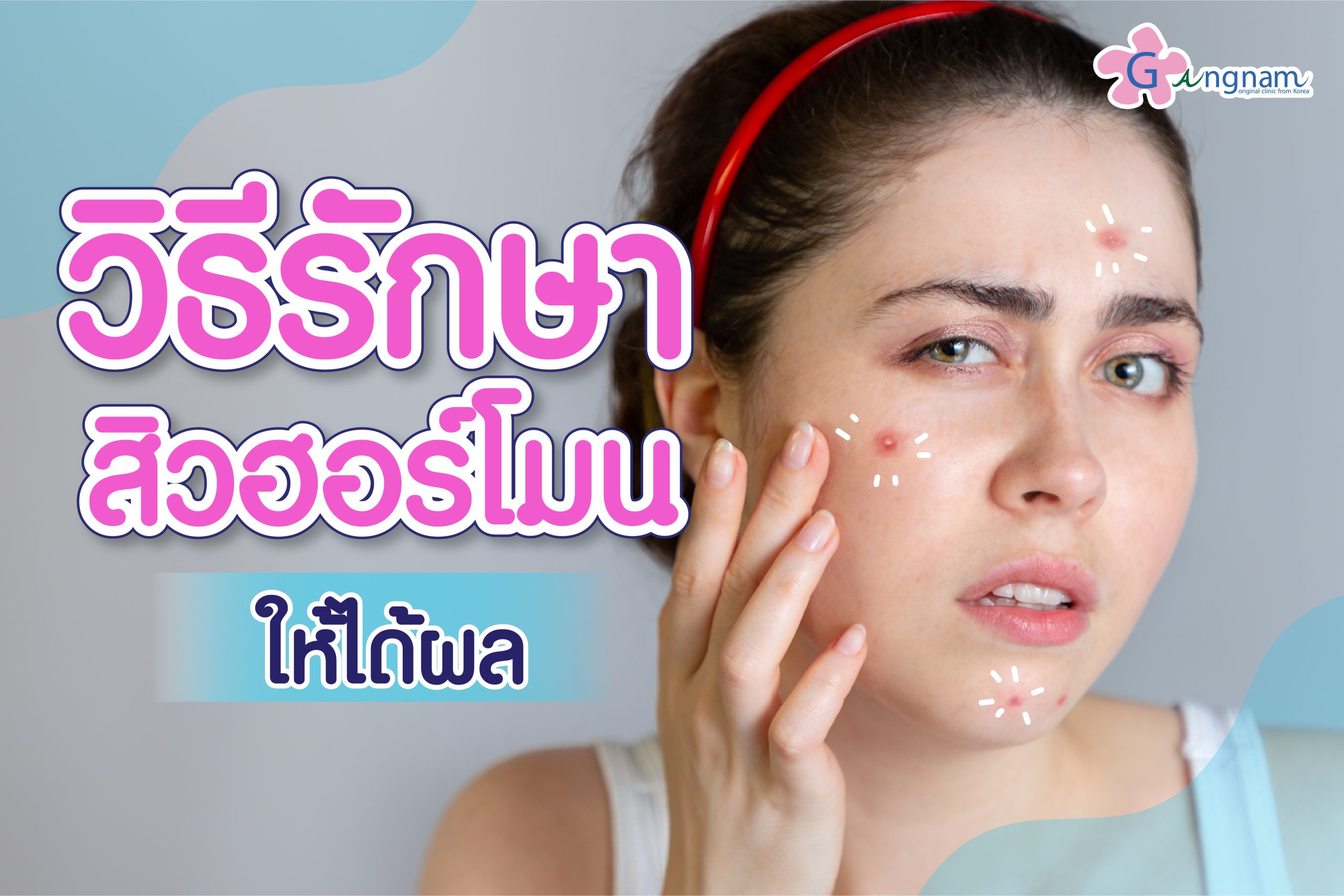 วิธีรักษาสิวฮอร์โมน