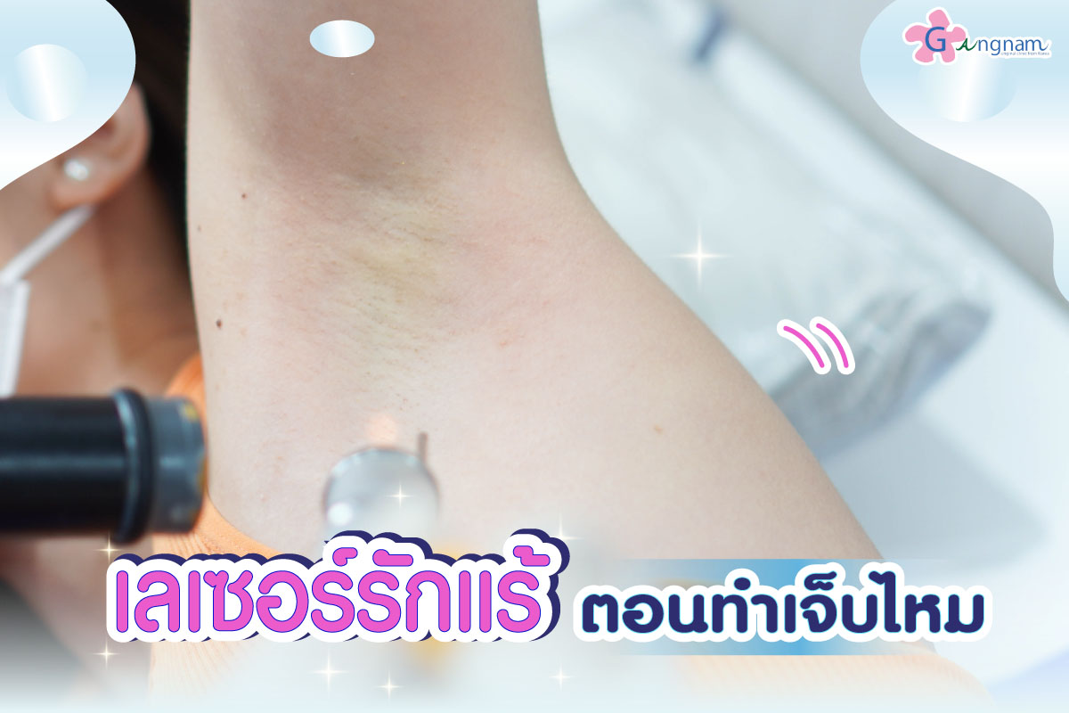 เลเซอร์ขนรักแร้เจ็บไหม