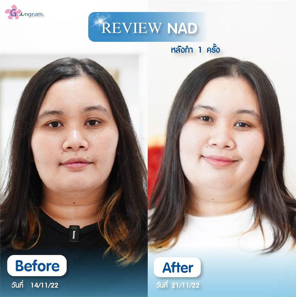 รีวิว NAD