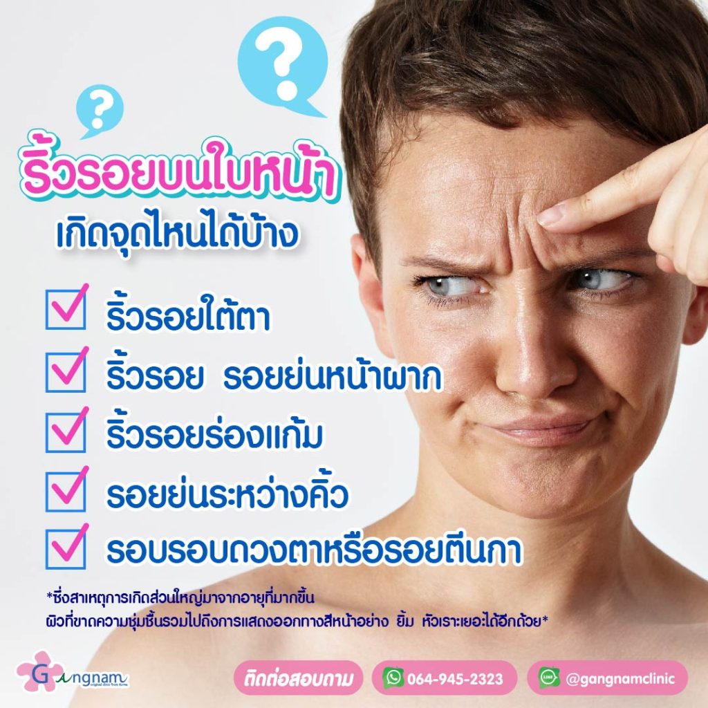 ตำแหน่งที่มักเกิดริ้วรอยบนใบหน้า