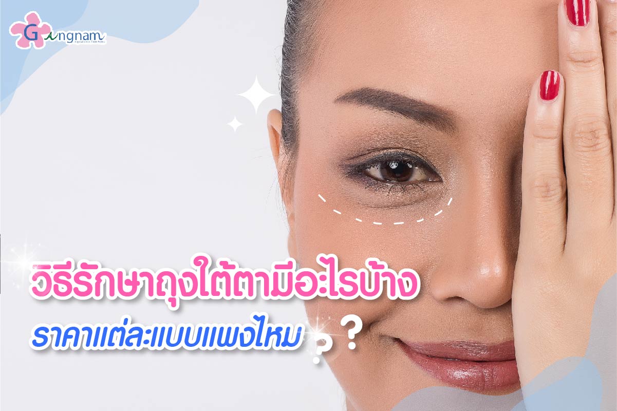 ถุงใต้ตา