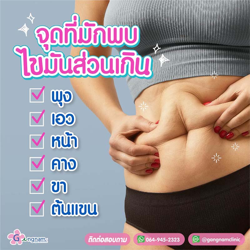 บริเวณที่มักเกิดไขมันส่วนเกิน
