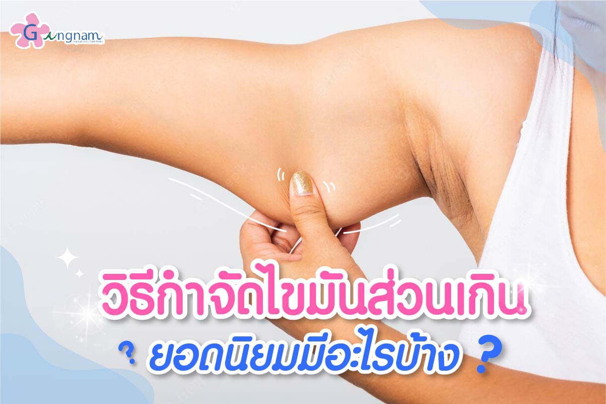 วิธีกำจัดไขมันส่วนเกิน