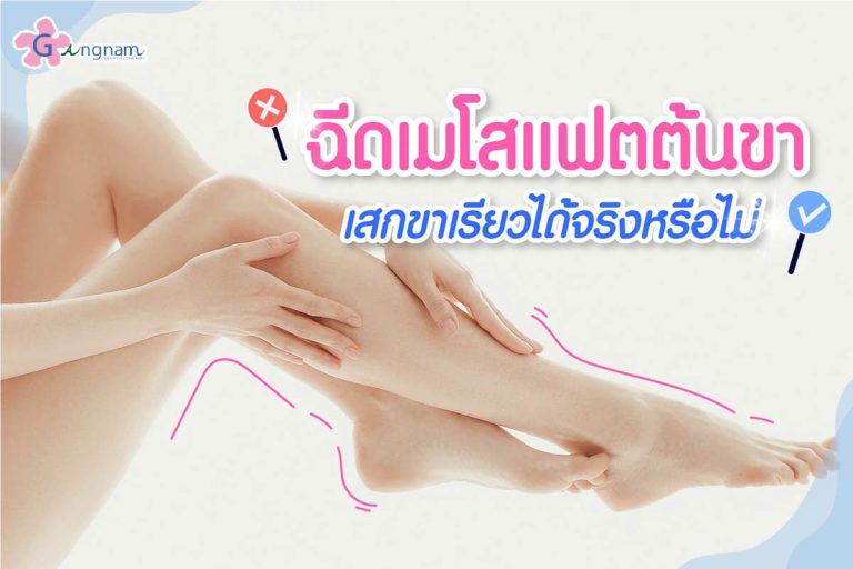 ฉีดเมโสแฟตต้นขา เสกให้ขาเรียว แบบไม่เจ็บ เหมาะกับใคร?