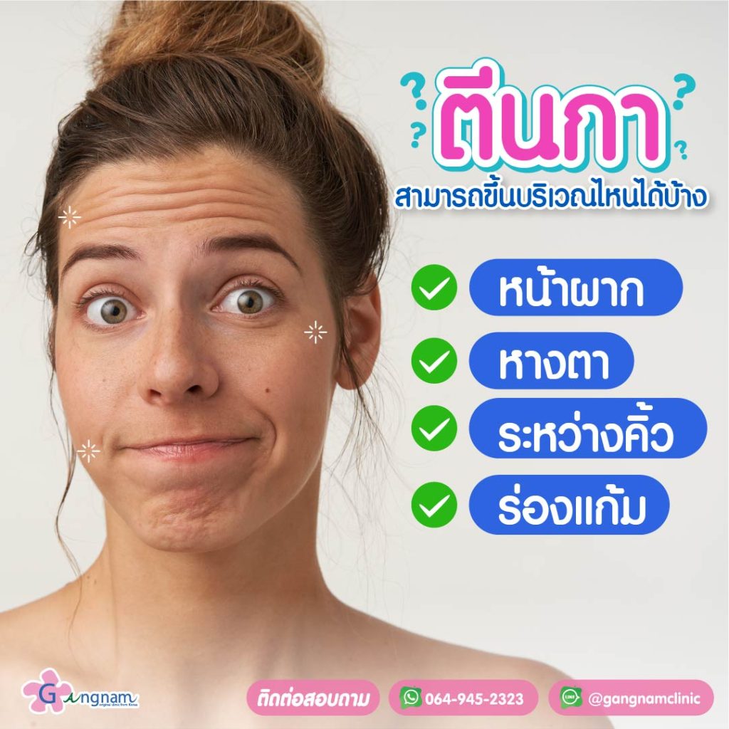 ตำแหน่งริ้วรอยตีนกา