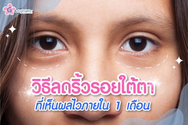 รวมวิธี ลดริ้วรอยใต้ตา ที่เห็นผลไวและปลอดภัย