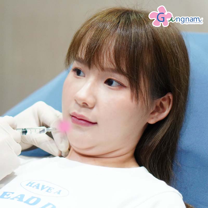 แนะนำ 14 วิธีลดเหนียงใต้คาง แบบเร่งด่วนภายใน 1 อาทิตย์ วิธีไหนได้ผลที่สุด แนะนำ 14 วิธีลดเหนียงใต้คาง แบบเร่งด่วนภายใน 1 อาทิตย์ วิธีไหนได้ผลที่สุด