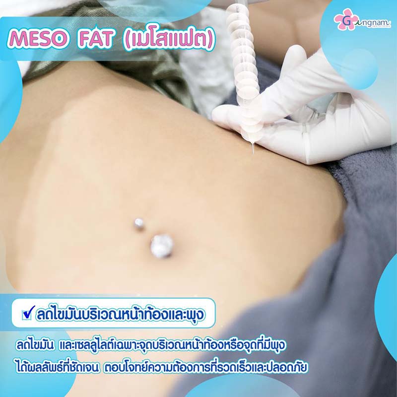 วิธีลดพุง ลดหน้าท้อง แบบเร่งด่วน สำหรับคนไม่มีเวลา - Gangnam Clinic วิธีลดพุง ลดหน้าท้อง แบบเร่งด่วน สำหรับคนไม่มีเวลา - Gangnam Clinic