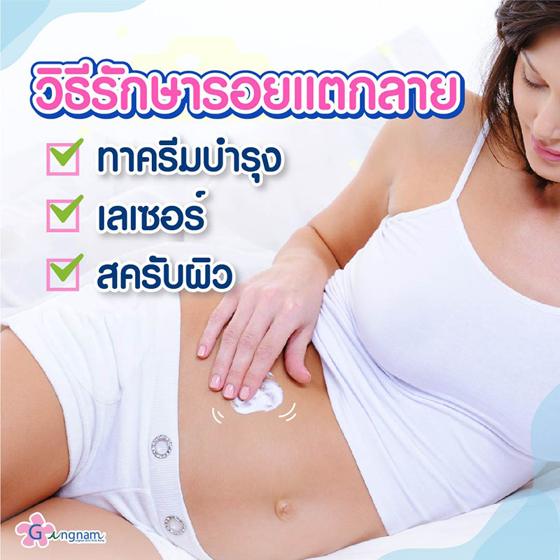รอยแตกลาย เกิดจากอะไร? มีกี่แบบ ใช้วิธีรักษาต่างกันไหม? รอยแตกลาย เกิดจากอะไร? มีกี่แบบ ใช้วิธีรักษาต่างกันไหม?