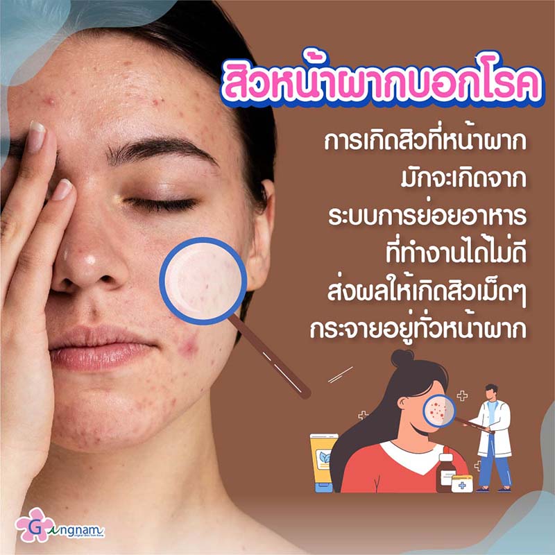 เป็นสิวที่หน้าผาก ไม่หายสักที เกิดจากอะไร? ควรรักษาด้วยวิธีไหนดี เป็นสิวที่หน้าผาก ไม่หายสักที เกิดจากอะไร? ควรรักษาด้วยวิธีไหนดี