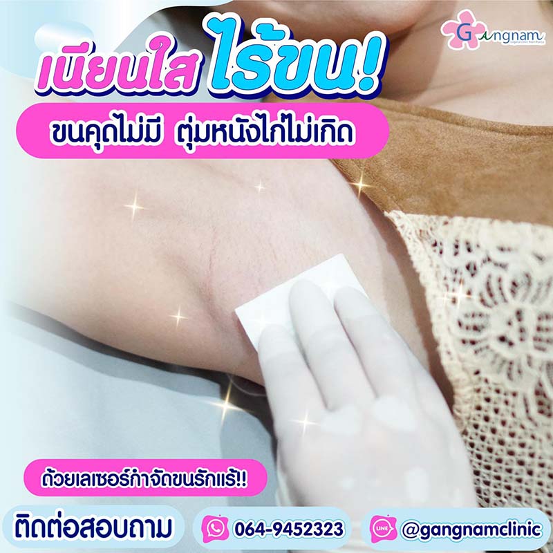รักแร้หนังไก่ เกิดจากอะไร? มีวิธีแก้ยังไง ให้ตุ่มหนังไก่หาย ผิว กลับมาเนียนนุ่ม รักแร้หนังไก่ เกิดจากอะไร? มีวิธีแก้ยังไง ให้ตุ่มหนังไก่หาย ผิว กลับมาเนียนนุ่ม