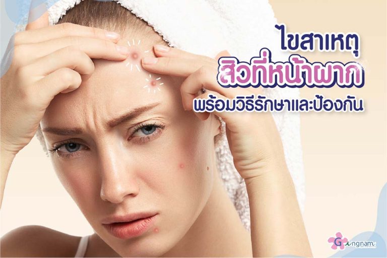 เป็นสิวที่หน้าผาก ไม่หายสักที เกิดจากอะไร? ควรรักษาด้วยวิธีไหนดี