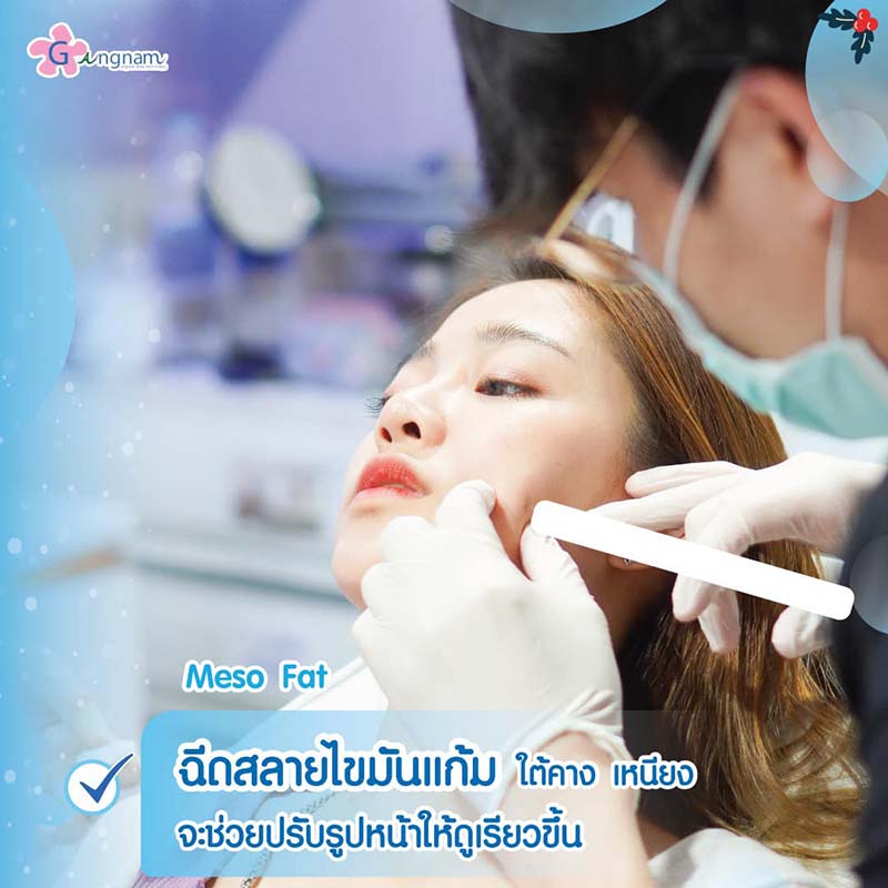 แนะนำวิธีลดแก้ม แก้มเยอะ แก้มใหญ่ ที่ผลได้เป็นธรรมชาติ แบบเร่งด่วน - Gangnam Clinic แนะนำวิธีลดแก้ม แก้มเยอะ แก้มใหญ่ ที่ผลได้เป็นธรรมชาติ แบบเร่งด่วน - Gangnam Clinic