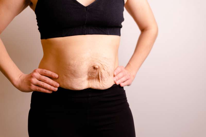 เซลลูไลท์ (Cellulite) คืออะไร? มีวิธีลดและกำจัดเซลลูไลท์อย่างไรให้เห็นผล - Gangnam Clinic เซลลูไลท์ (Cellulite) คืออะไร? มีวิธีลดและกำจัดเซลลูไลท์อย่างไรให้เห็นผล - Gangnam Clinic