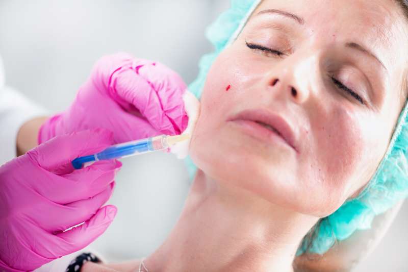 ฟิลเลอร์ Restylane มีกี่รุ่น เหมาะกับฉีดจุดไหนบ้าง