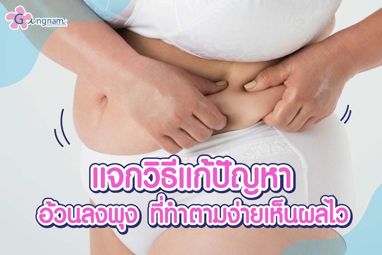 อ้วนลงพุง ลดยังไง? สาเหตุเกิดจากอะไร? สามารถป้องกันและรักษาได้อย่างไร