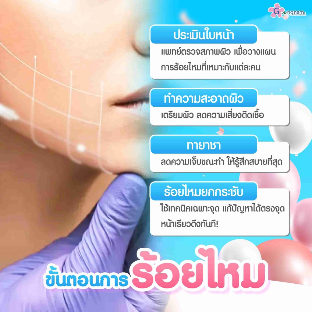 ขั้นตอนการร้อยไหม