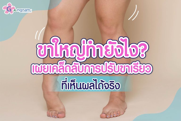 สาเหตุ ขาใหญ่ เกิดจากอะไร? มีวิธีลดขาใหญ่ อย่างไรให้ปลอดภัย แบบเร่งด่วน