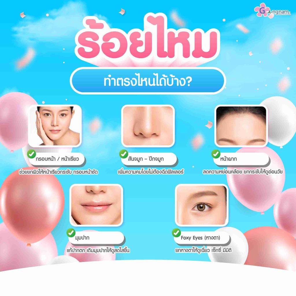 บริเวณที่เหมาะกับการร้อยไหม