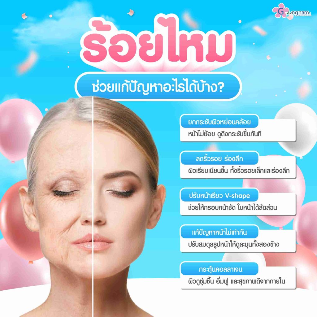 ประโยชน์ของการร้อยไหม