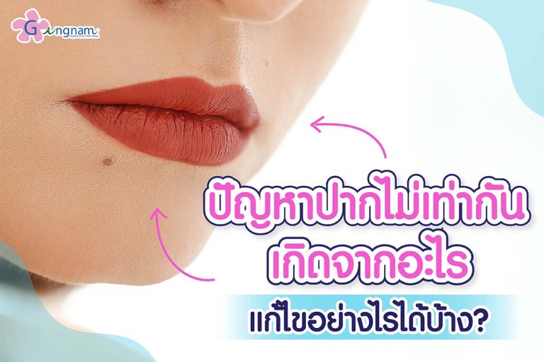 ริมฝีปากปากไม่เท่ากัน เกิดจากอะไร? มีวิธีแก้ไขอย่างไรบ้าง?