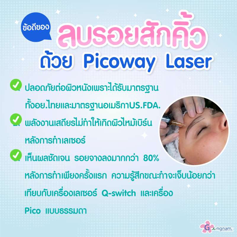 ลบรอยสักคิ้วด้วย Picoway ดียังไง