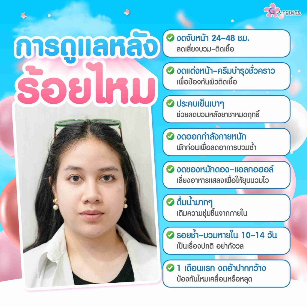เคล็ดลับดูแลตัวเองหลังทำ