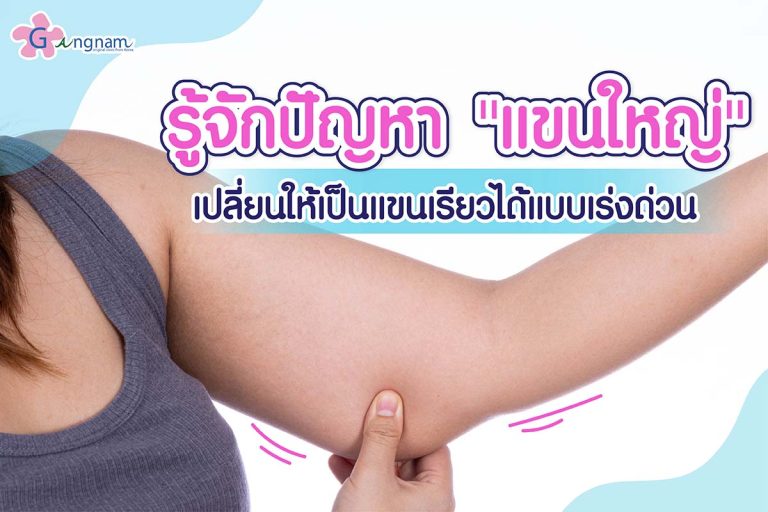 รู้จักปัญหา “แขนใหญ่” เปลี่ยนให้เป็นแขนเรียวได้แบบเร่งด่วน