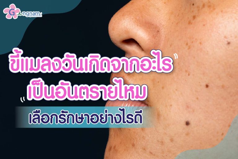 7 วิธีทําให้หน้าใส ไร้สิว วิธีไหนช่วยให้ผิวกระจ่างใสแบบธรรมชาติ และได้ผลจริง 7 วิธีทําให้หน้าใส ไร้สิว วิธีไหนช่วยให้ผิวกระจ่างใสแบบธรรมชาติ และได้ผลจริง