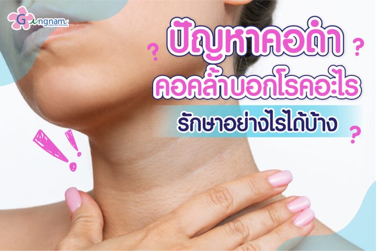 ปัญหาคอดำ คอคล้ำบอกโรคอะไร รักษาอย่างไรได้บ้าง