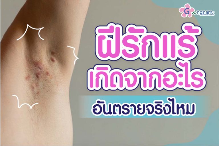 ฝีที่รักแร้ เกิดจากอะไร? อันตรายไหม? สามารถป้องกันและรักษาด้วยวิธีไหนบ้าง?