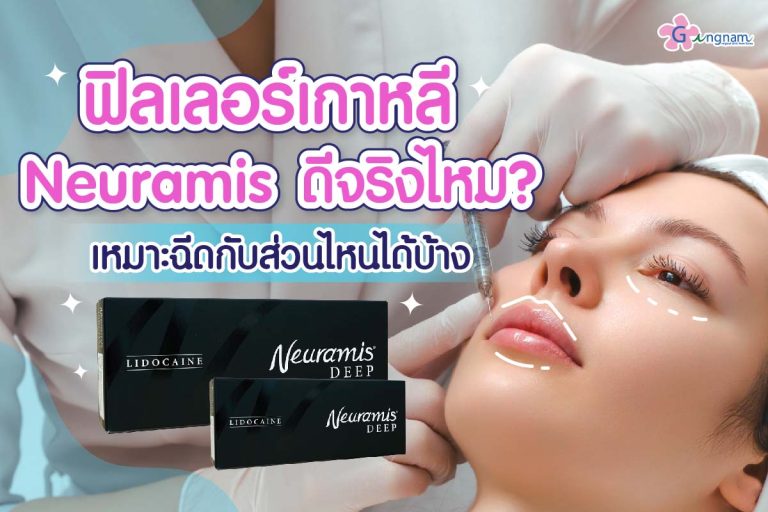 รู้จัก ฟิลเลอร์ Neuramis ดีไหม? มีกี่แบบ เหมาะกับฉีดตำแหน่งไหน?