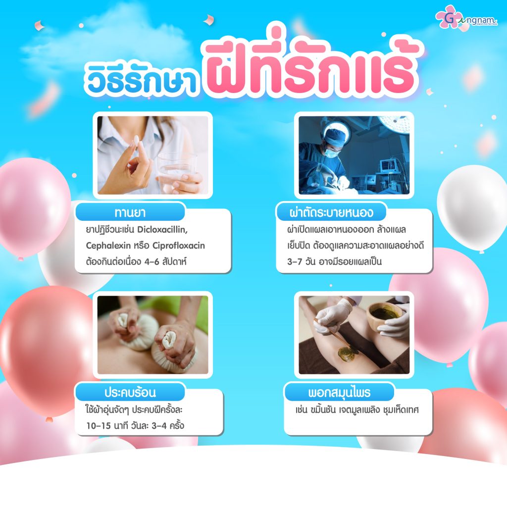 วิธีรักษาฝีรักแร้