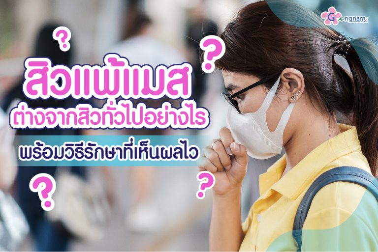 รู้จักกับ สิวแพ้แมส เป็นยังไง? มีวิธีรักษาและป้องกันอย่างไรให้หายสนิท