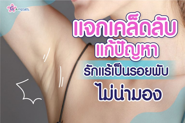 รักแร้เป็นรอยพับ สาเหตุเกิดจากอะไร มีวิธีรักษาและป้องกันอย่างไรบ้าง