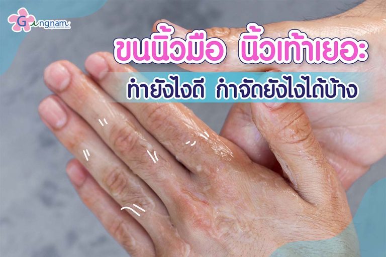 ขนนิ้วมือ นิ้วเท้าเยอะ ทำยังไงดี กำจัดด้วยวิธีไหนได้บ้าง?