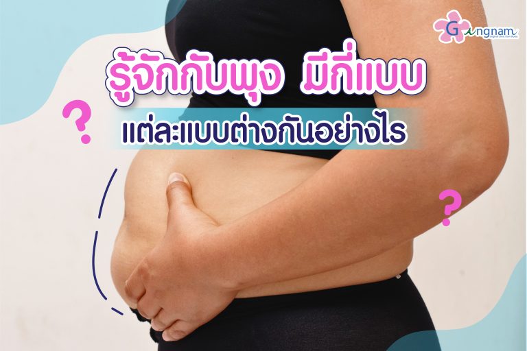 พุง มีกี่แบบ? ลักษณะอย่างไร พุงแต่ละแบบใช้วิธีลดอย่างไรถึงเหมาะสม