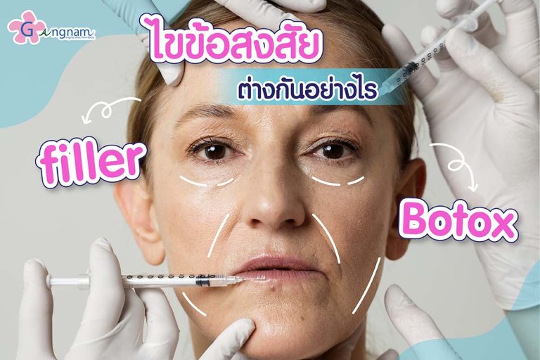 เปรียบเทียบ Filler กับ Botox ต่างกันอย่างไร? เลือกฉีดอะไรก่อนดี?