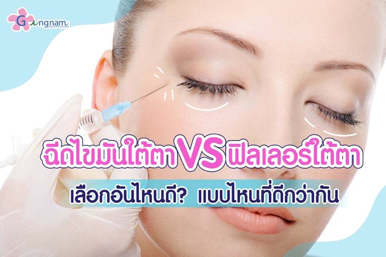 ฉีดไขมันใต้ตา VS ฟิลเลอร์ใต้ตาเลือกอันไหนดี? แบบไหนที่ดีกว่ากัน