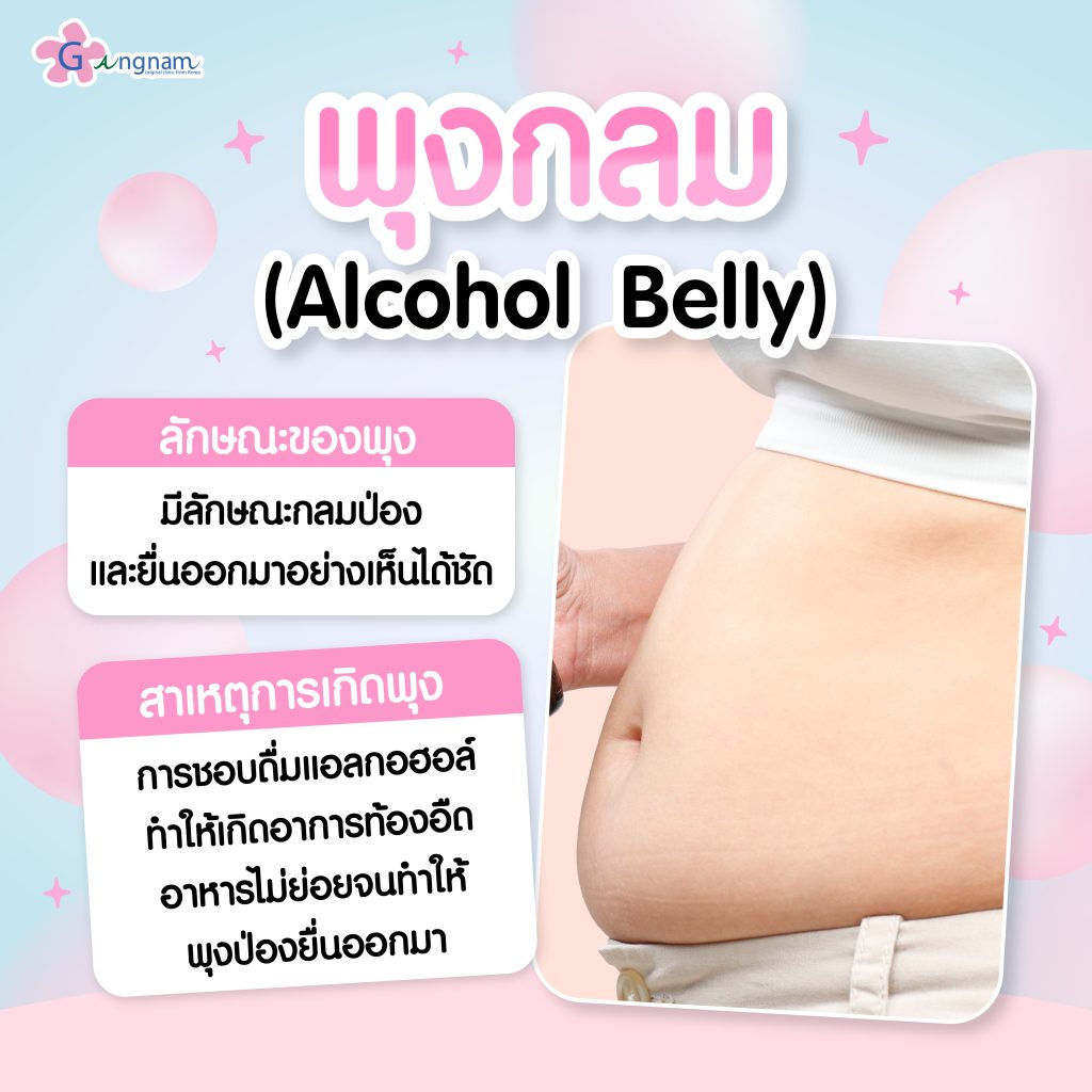 พุงกลม (Alcohol Belly)