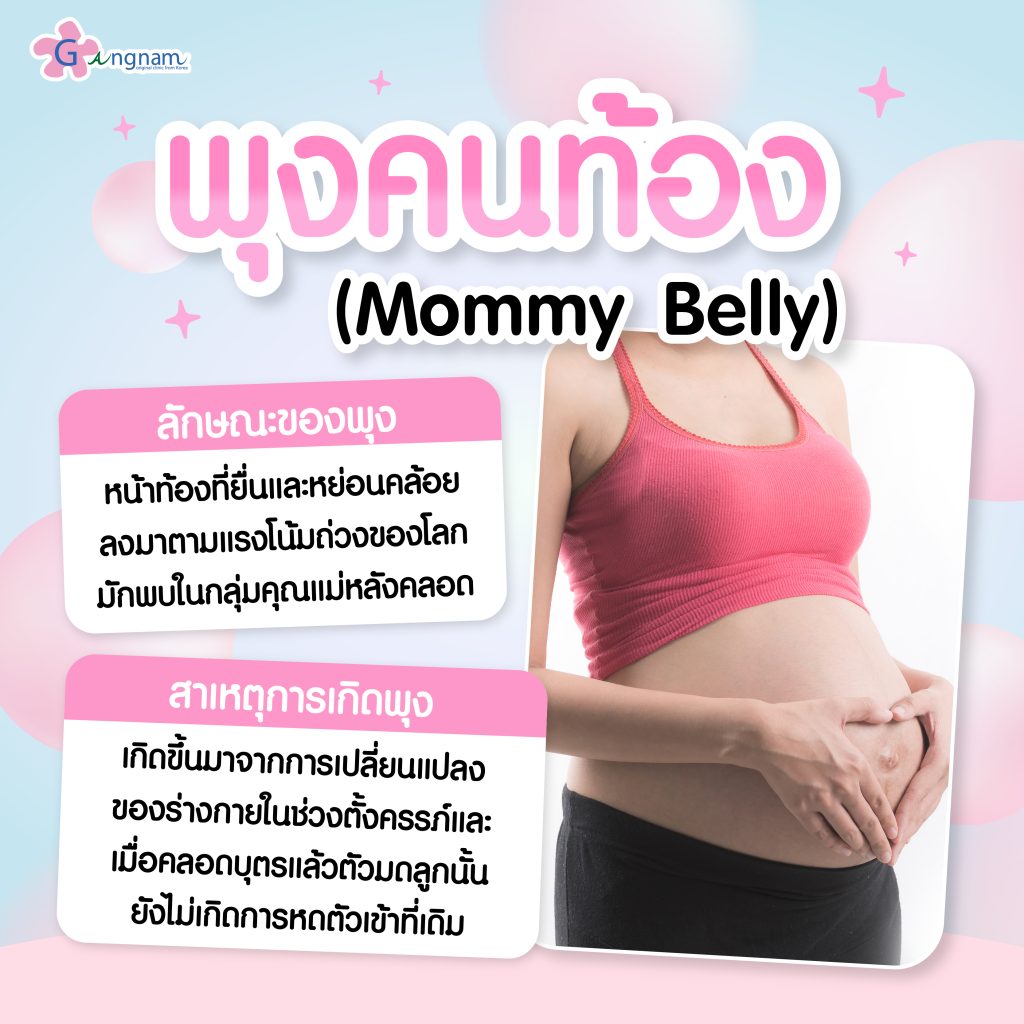 พุงคนท้อง (Mommy Belly)