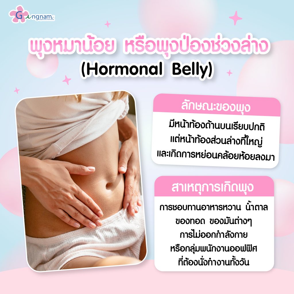 พุงหมาน้อย หรือพุงป่องช่วงล่าง (Hormonal Belly)