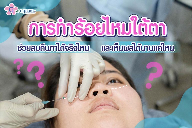 ร้อยไหมใต้ตา เหมาะกับใคร? ช่วยลบตีนกาได้จริงไหม และเห็นผลได้นานแค่ไหน