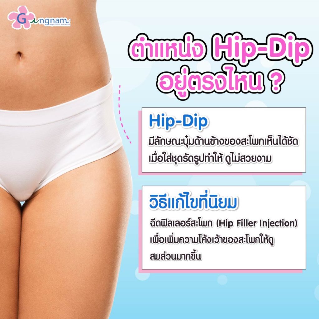 ความหมายฟิลเลอร์สะโพก